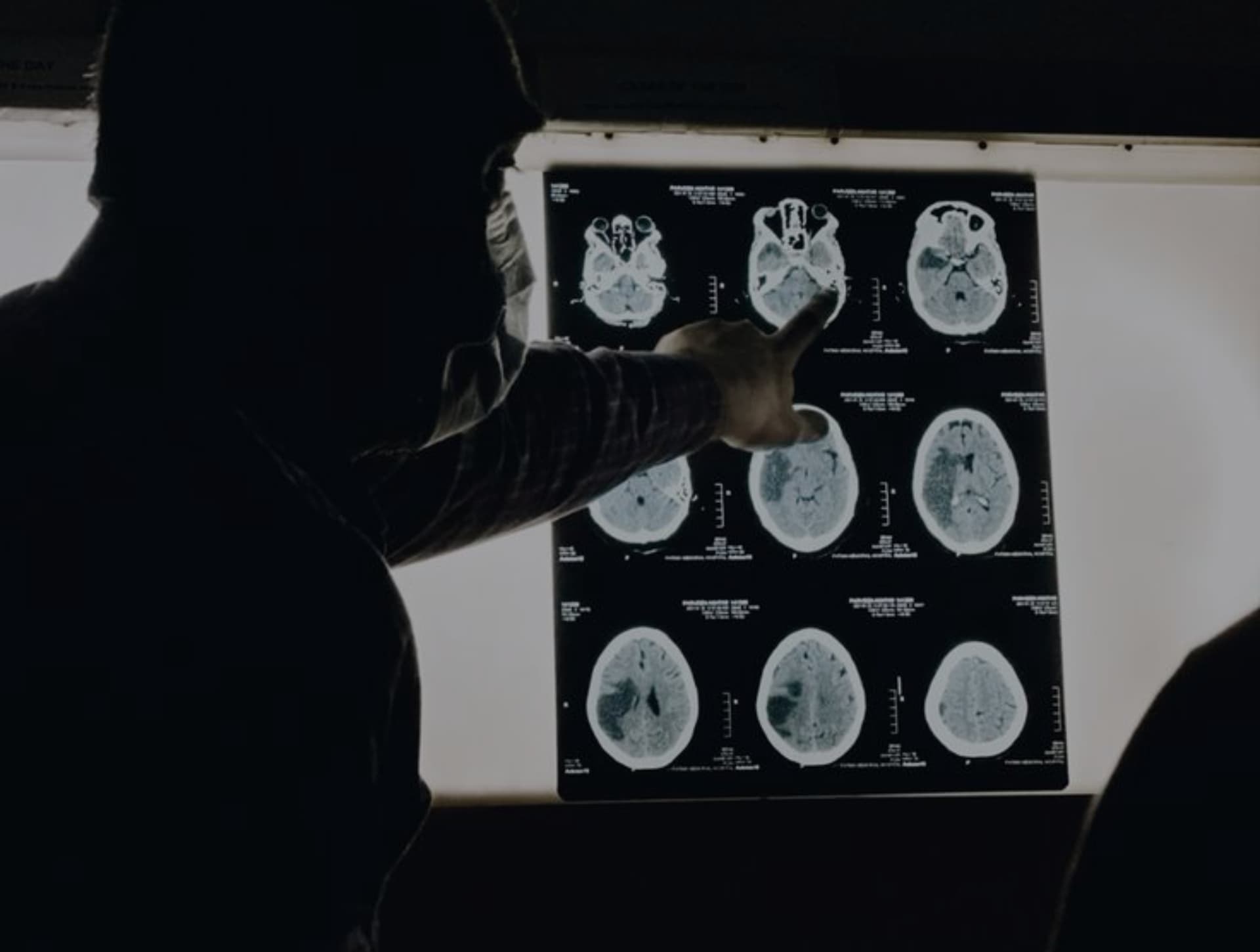 Rezonans Magnetyczny